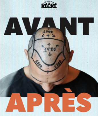 AVANT / APRES